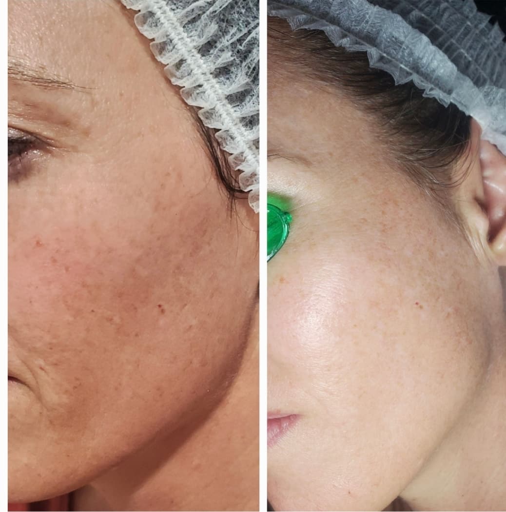 The Brightening Ritual — bundle deal at 360 Radiance