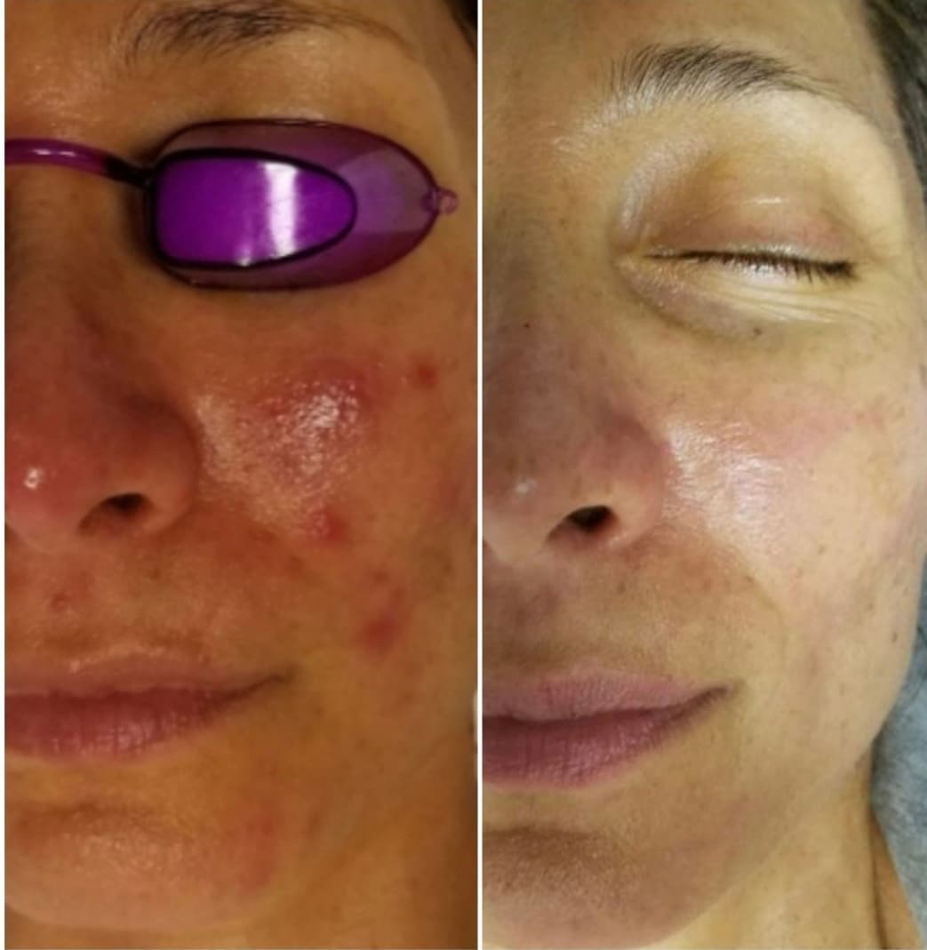 The Sensitive Skin Calm Set — bundle deal at 360 Radiance